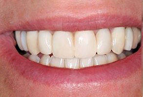 Queens Dental Design Queens Dental Design
