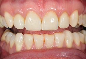Queens Dental Design Queens Dental Design