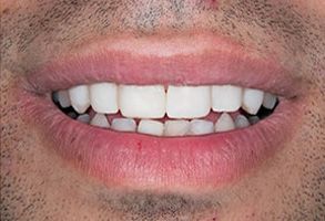 Queens Dental Design Queens Dental Design