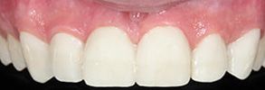 Queens Dental Design Queens Dental Design