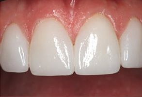 Queens Dental Design Queens Dental Design