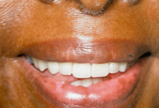Queens Dental Design Queens Dental Design
