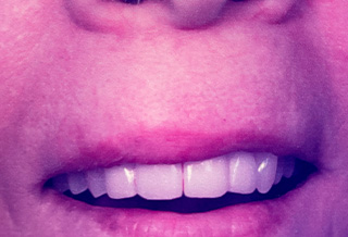 Queens Dental Design Queens Dental Design