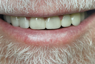 Queens Dental Design Queens Dental Design