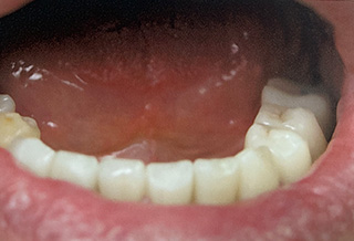 Queens Dental Design Queens Dental Design