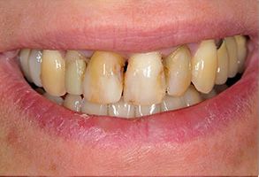 Queens Dental Design Queens Dental Design