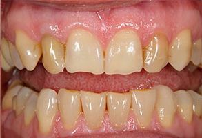 Queens Dental Design Queens Dental Design