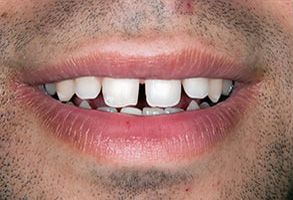 Queens Dental Design Queens Dental Design