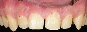 Queens Dental Design Queens Dental Design