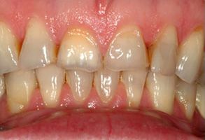 Queens Dental Design Queens Dental Design