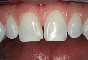 Queens Dental Design Queens Dental Design