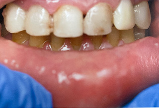 Queens Dental Design Queens Dental Design
