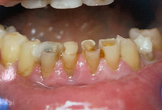 Queens Dental Design Queens Dental Design
