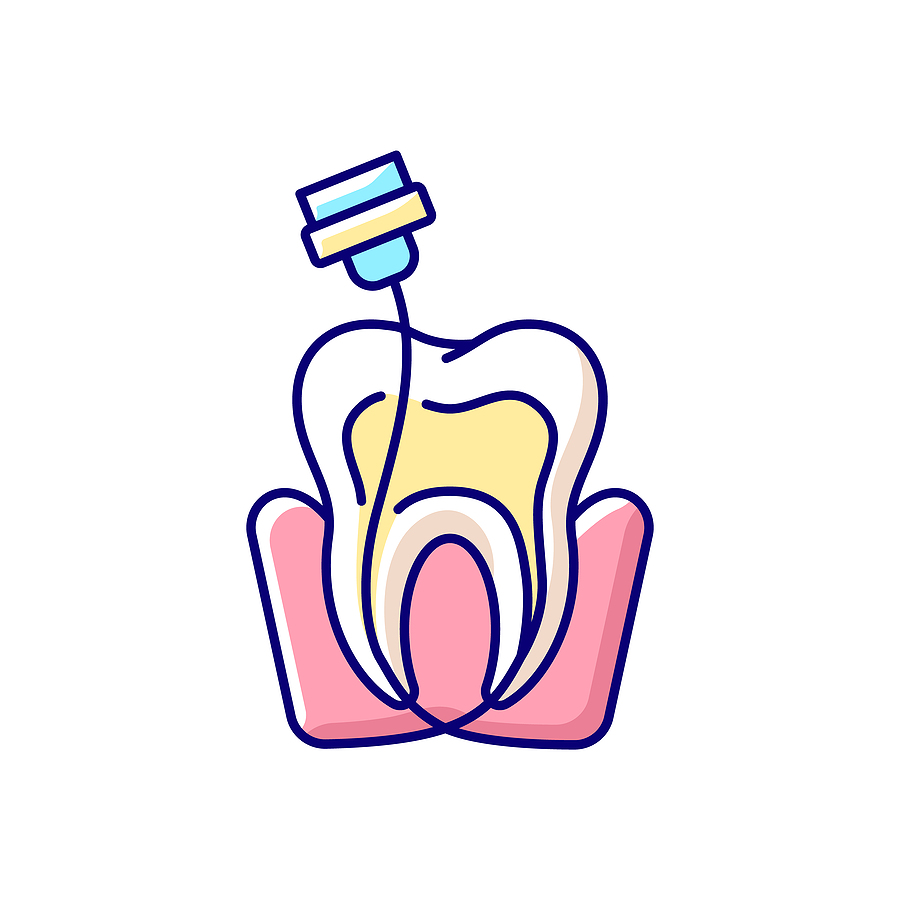 Root Canals